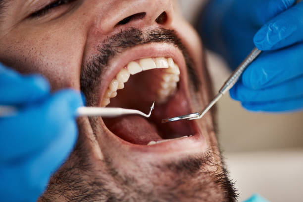 Best Knocked-Out Tooth Emergency  in Hephzibah, GA